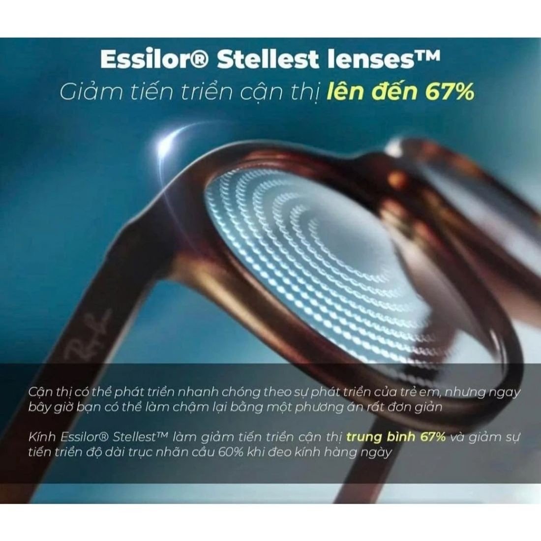 Hiệu quả kiểm soát cận thị 67%